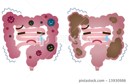 Colon of large intestine constipation sick Colon of large intestine constipation sick 13930986