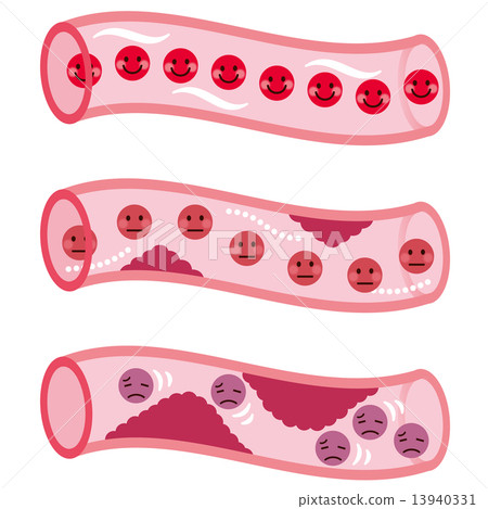 Blood flow section blood flow 13940331