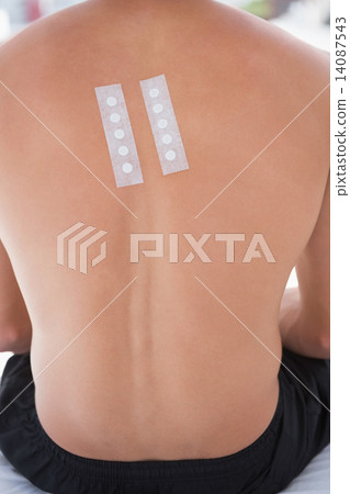 Patient with skin test in his back 14087543