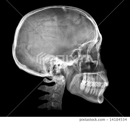 Human skull X-ray image 14184534