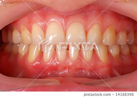 human teeth 14188398