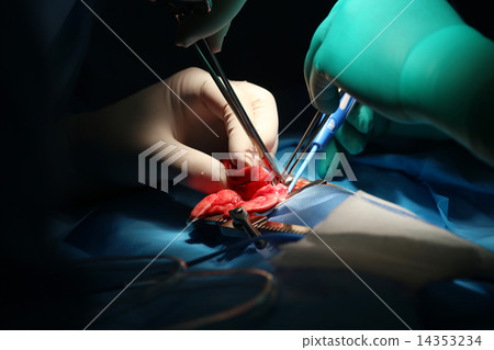 Macro shot of an infant lung surgery Macro shot of an infant lung surgery 14353234