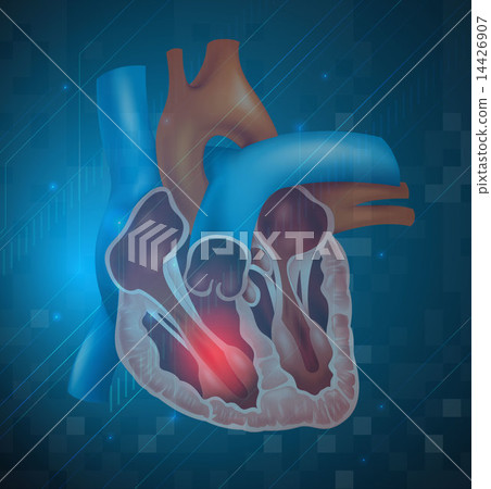 Heart attack 14426907