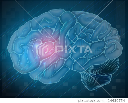 Brain with pain 14430754