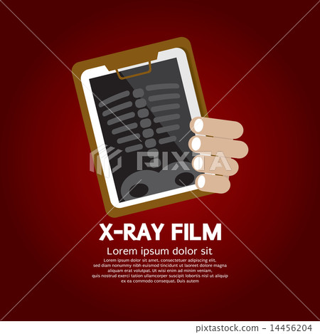 X-Ray Film X-Ray Film 14456204