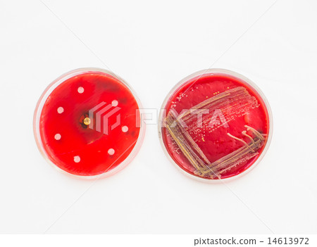 Petri dishes with growing bacteria Petri dishes with growing bacteria 14613972