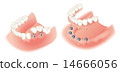 Implant 14666056
