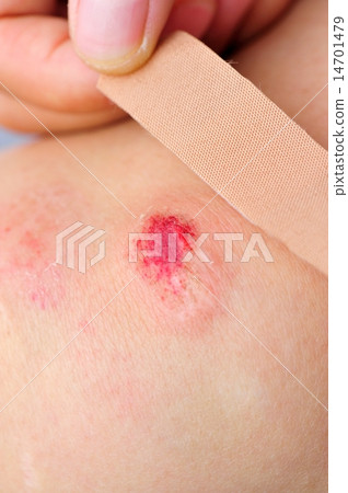 sports injured knee sports injured knee 14701479