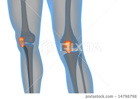 3d render medical illustration of the patella bone 14798798