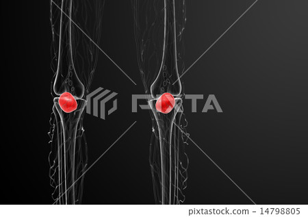 3d render medical illustration of the patella bone 14798805