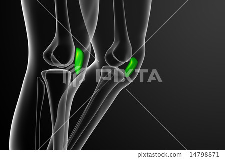 3d render medical illustration of the patella bone 14798871