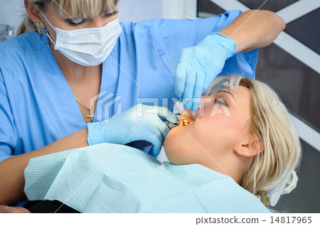 dentist at work, anaesthesia injection 14817965