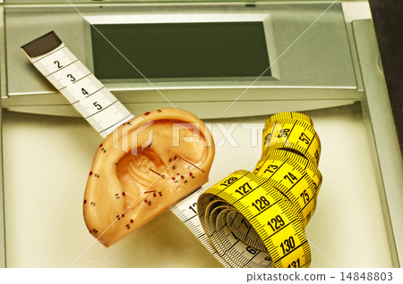 acupuncture for weight loss acupuncture for weight loss 14848803