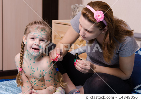 Girl suffering from chicken pox yells when my mother misses sores zelenkoj 14849050