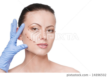 Correction lines on woman face, before surgery operetion Correction lines on woman face, before surgery operetion 14896502