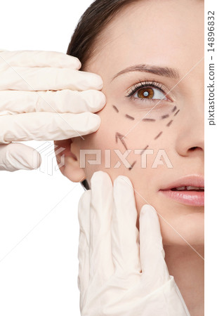 Correction lines on woman face, before surgery operetion 14896832