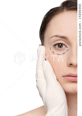 Correction lines on woman face, before surgery operetion 14896900
