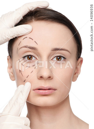 Correction lines on woman face, before surgery operetion 14896936