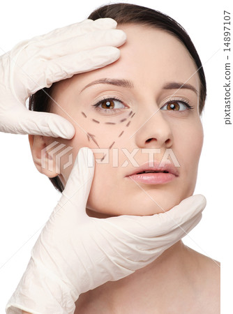 Correction lines on woman face, before surgery operetion 14897107
