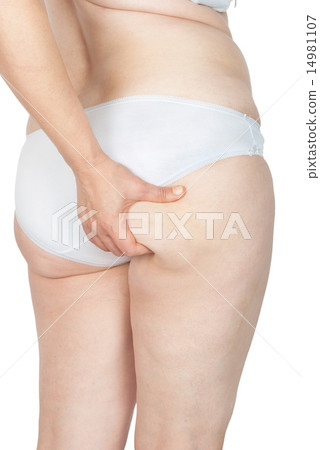 Women's cellulite Women's cellulite 14981107