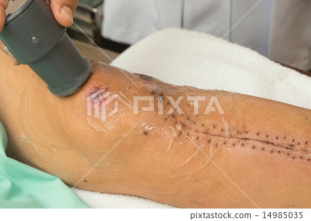 Physiotherapist treats knee surgery wound 14985035