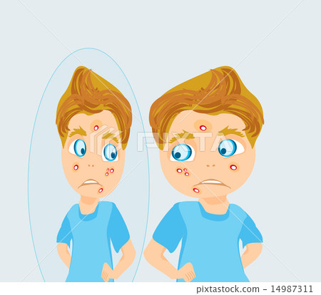 boy in puberty with acne boy in puberty with acne 14987311