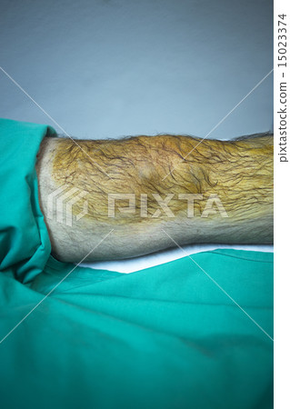 Patient in hospital clinic before injection of PRP 15023374