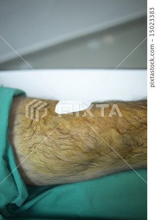 Patient in hospital clinic after injection of PRP 15023383