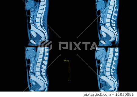 computer tomography of  human body 15030091