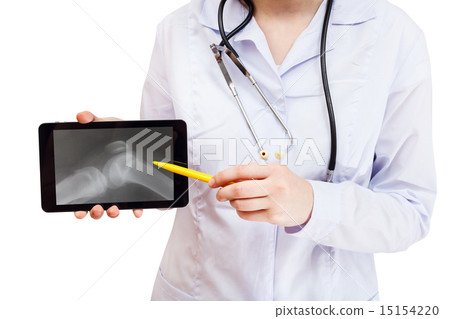 nurse points on tablet pc with human knee joint 15154220