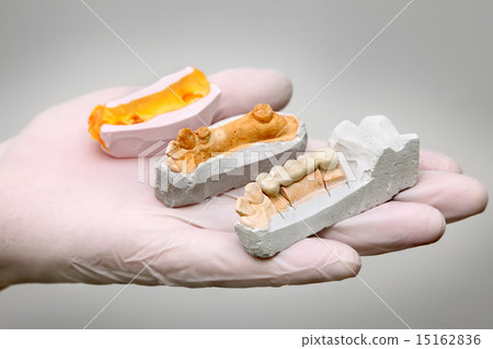 Dental,  plaster and wax models in hand 15162836