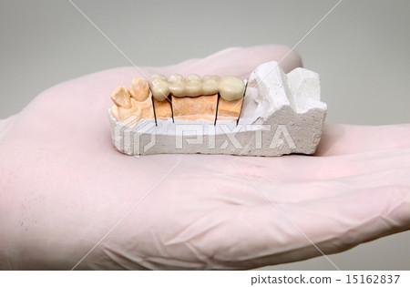 Dental,  plaster model in hand 15162837