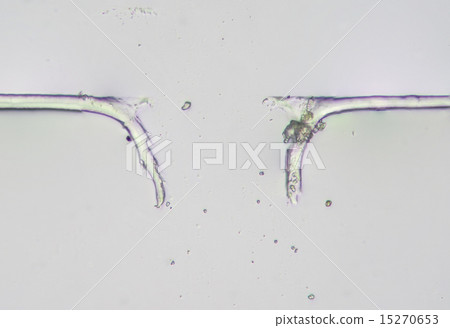 Photomicrograph of thread of broken natto 15270653