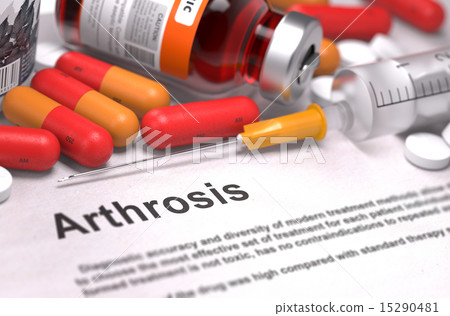 Arthrosis Diagnosis. Medical Concept.  15290481