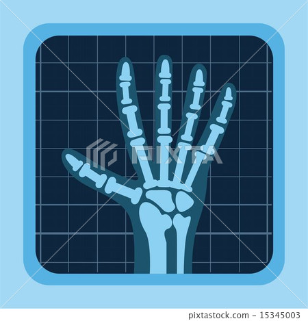 x rays design x rays design 15345003