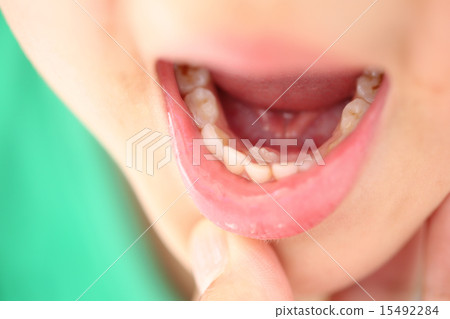 Adult teeth are growing Adult teeth are growing 15492284
