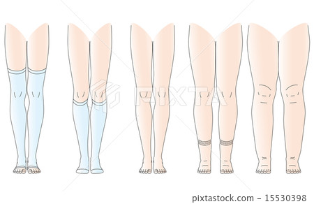 水腫的腿不可水腫的腿 15530398