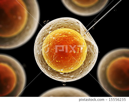 Artificial insemination 15556235