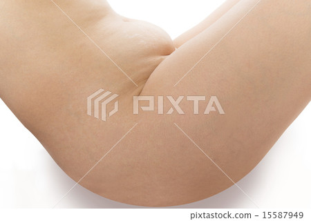 手術痕跡 15587949