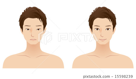 Male face cosmetic surgery dual surgery Male face cosmetic surgery dual surgery 15598239