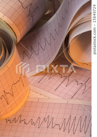 Electrocardiograph Traces - Cardiac Arrhythmia 15649724