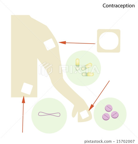 Different Items of Contraception and Birth Control Different Items of Contraception and Birth Control 15702007
