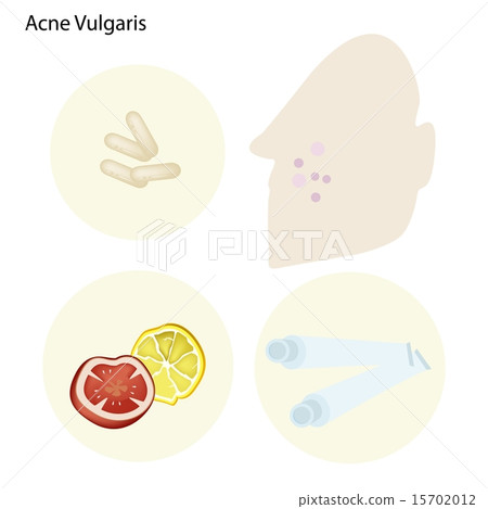 Acne Vulgaris and Take Care Facial Skin 15702012