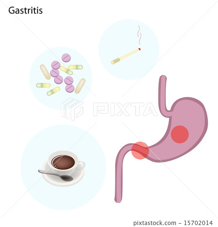 Stomach Disorder Concept on A White Background Stomach Disorder Concept on A White Background 15702014