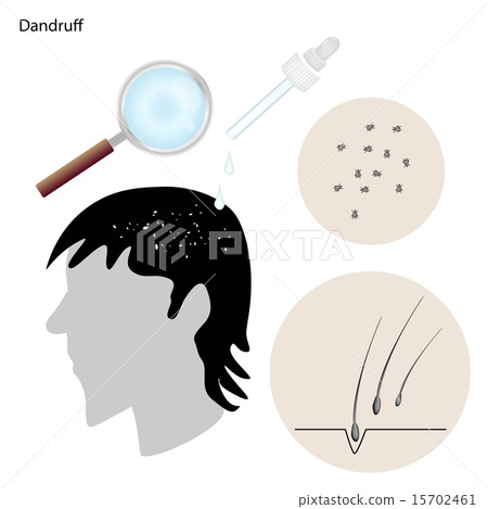 Dandruff with The Disease Prevention and Treatment 15702461
