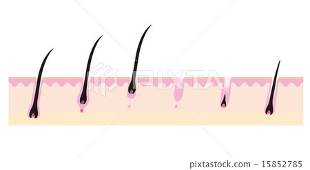 Image schematic of hair cycle Image schematic of hair cycle 15852785
