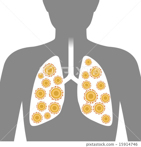 肺和病毒圖像圖 15914746