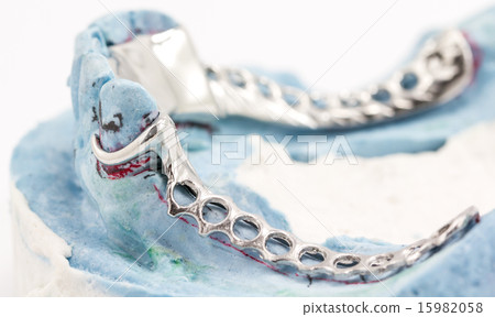 Dental wire bending Dental wire bending 15982058