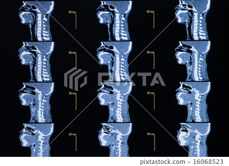 images from a computerized tomography of neck 16068523