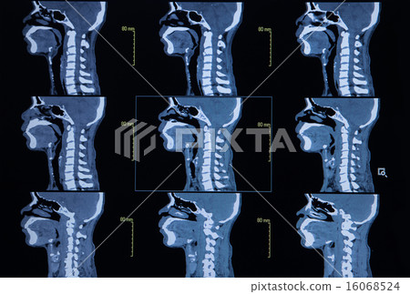 images from a computerized tomography of neck 16068524